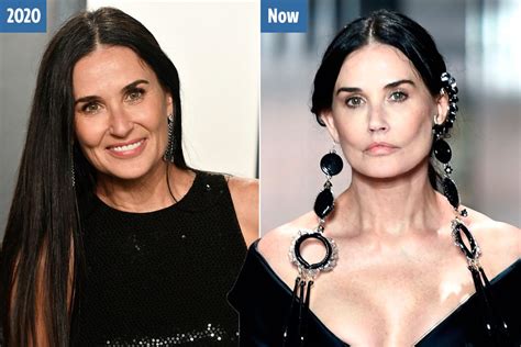 demi moore surgery fendi|demi moore plastic surgery.